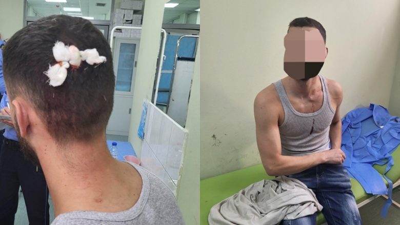 Policia thotë se sulmi ndaj dy shqiptarëve në veri u krye nga një grup kriminelësh – të njëjtit pranuan tretman mjekësor