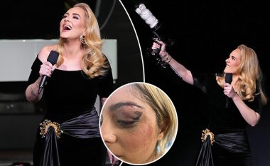 "As mos guxo", Adele ndërpret koncertin e saj për të dënuar fenomenin në rritje të fansave që po i gjuajnë me objekte artistët në skenë