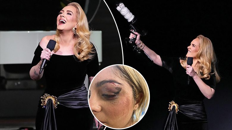“As mos guxo”, Adele ndërpret koncertin e saj për të dënuar fenomenin në rritje të fansave që po i gjuajnë me objekte artistët në skenë