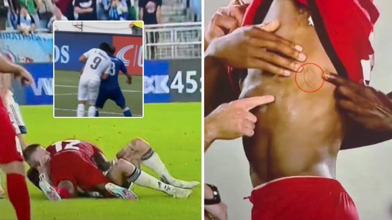“Shpirti i Luis Suarezit hyri në trupin e Juraj Kucka” – Sllovaku kafshoi kundërshtarin dhe mori karton të kuq direkt