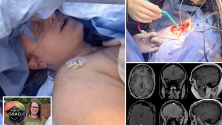 Gruaja këndonte gjersa mjekët ia hiqnin tumorin e trurit në një spital në New Jersey