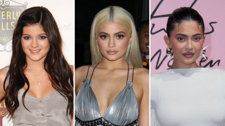 Kylie Jenner e mohon sërish me këmbëngulje se nuk ka bërë asnjë ndërhyrje plastike në fytyrë