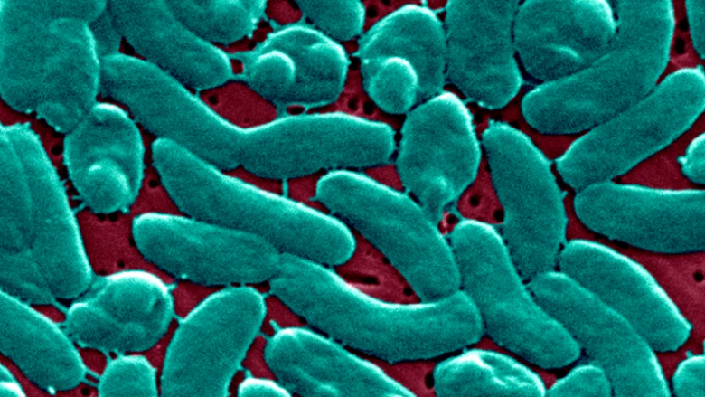 Tre persona vdesin nga infeksionet e “baktereve mishngrënëse” në New York dhe Connecticut, duke nxitur udhëzime të reja