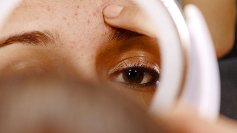 Me një test të thjeshtë në shtëpi, mund të përcaktoni lehtësisht pse fytyra juaj u skuqet edhe pse nuk jeni në pubertet
