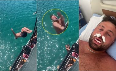 Turisti britanik vendosi të kërcente nga prapa në det – përplas fytyrën në anën e një varke, duke lënduar rëndë hundën dhe nofullën