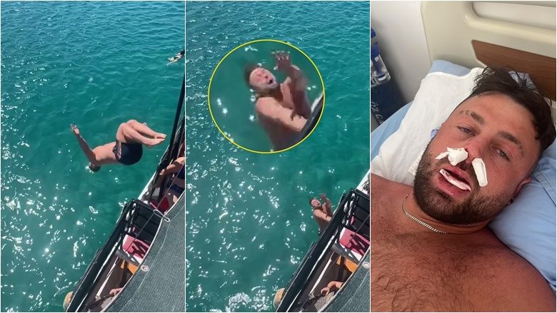 Turisti britanik vendosi të kërcente nga prapa në det – përplas fytyrën në anën e një varke, duke lënduar rëndë hundën dhe nofullën
