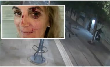Një grua goditet në fytyrë me një shishe metalike – policia amerikane publikon pamjet e sulmit në Portland