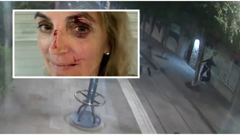 Një grua goditet në fytyrë me një shishe metalike – policia amerikane publikon pamjet e sulmit në Portland