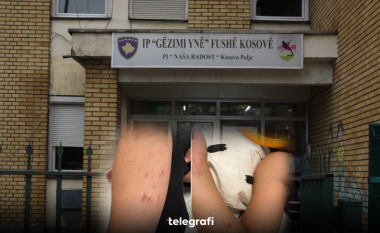 Drejtori i Arsimit në Fushë Kosovë: Tri edukatoret që dyshohet se ushtruan dhunë ndaj trevjeçarit po intervistohen nga Policia, do të marrim masa ndaj tyre