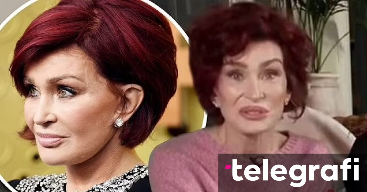 Humbja drastike në peshë, Sharon Osbourne pranon se kalon të paktën tri ditë në javë pa ngrënë