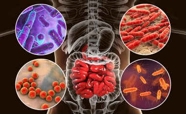 Si ndikon puna e zorrëve dhe shëndeti i mikrobiomës në zhvillimin e disa sëmundjeve autoimune