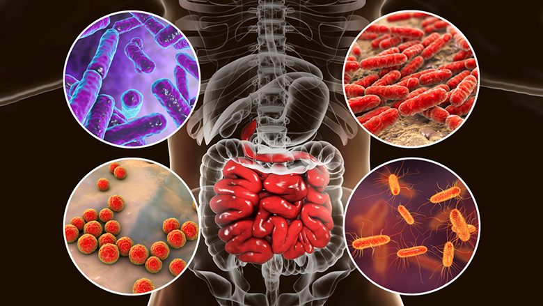 Si ndikon puna e zorrëve dhe shëndeti i mikrobiomës në zhvillimin e disa sëmundjeve autoimune