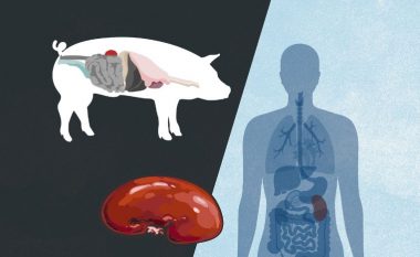 Shkencëtarët me hapa historike – veshkën e njerëzve e rritin te derrat