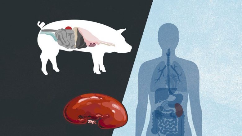 Shkencëtarët me hapa historike – veshkën e njerëzve e rritin te derrat