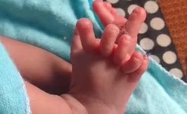 Foshnja në Indi u lind me 26 gishta