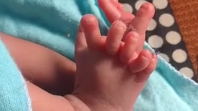 Foshnja në Indi u lind me 26 gishta