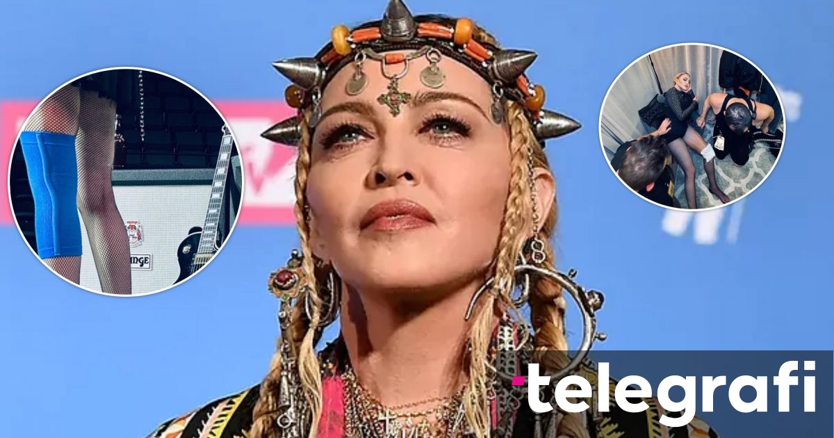 Madonna worries fans again, shows signs of injuries during rehearsals ...