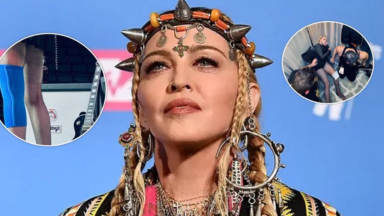 Madonna shqetëson sërish fansat, shfaq shenja e lëndime gjatë provave për turneun botëror