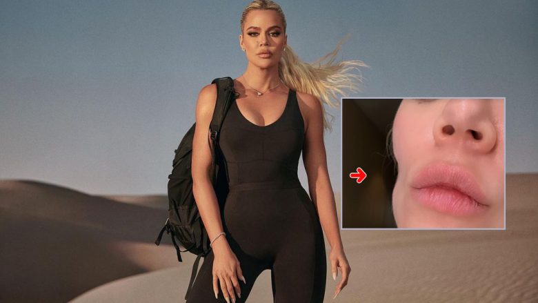 Khloe Kardashian tregon fytyrën pas operacionit për heqjen e një forme të kancerit të lëkurës