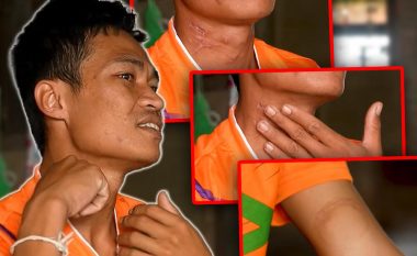 Rrëfimi i emigrantit tajlandez që i mbijetoi sulmit të Hamasit, militanti deshi t’ia presë kokën – e “shpëtoi” thika që nuk ishte e mprehtë
