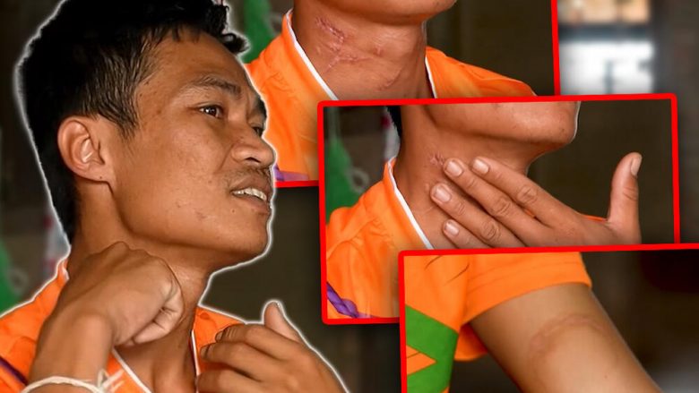 Rrëfimi i emigrantit tajlandez që i mbijetoi sulmit të Hamasit, militanti deshi t’ia presë kokën – e “shpëtoi” thika që nuk ishte e mprehtë