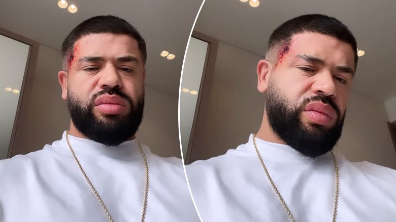 Noizy publikon video me gjakosje në fytyrë, shqetësohen fansat