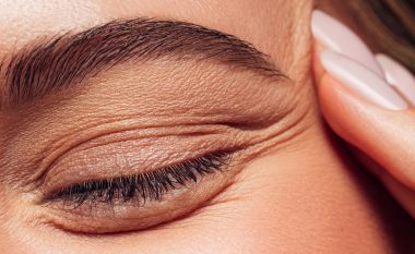 ‘Pickimi i lëkurës’: Ç’duhet të dini për teknikën për qepallat e varura të syve