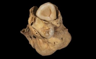 Një tumor i çuditshëm është gjetur në trupin e një gruaje të lashtë egjiptiane