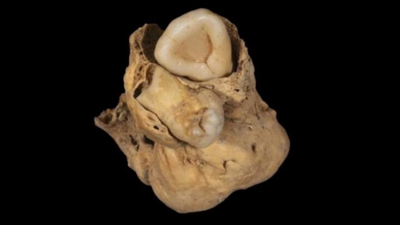 Një tumor i çuditshëm është gjetur në trupin e një gruaje të lashtë egjiptiane