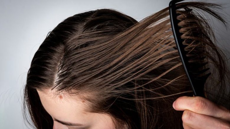 Nuk bëhet fjalë as për shampo as për balsam: Nëse flokët tuaj bëhen të yndyrta shpejt, po bëni një gabim të zakonshëm