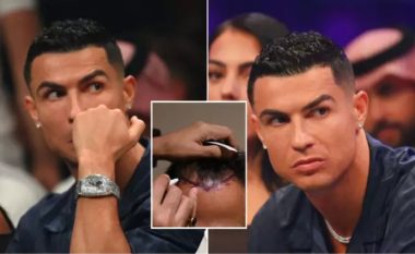 Klinikat e transplantit të flokëve të Cristiano Ronaldos nën hetim nga autoritetet tatimore spanjolle