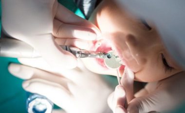 Ndërhyrja tek dentisti, del ekspertiza mjeko-ligjore: 3-vjeçari vdiq nga mbidoza e anestezisë