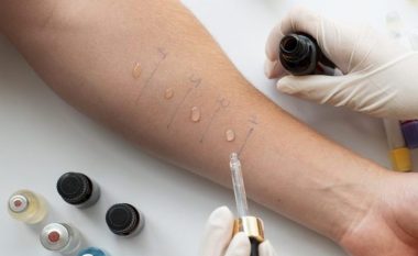 ​Klinika e Dermatologjisë tash e disa vite pa teste të alergjisë