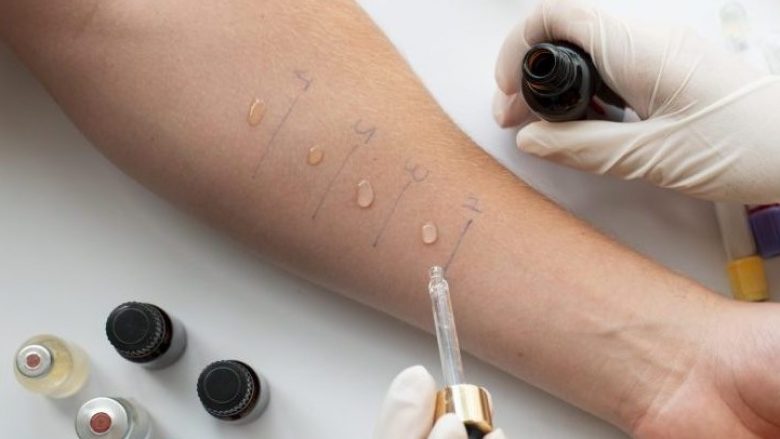​Klinika e Dermatologjisë tash e disa vite pa teste të alergjisë
