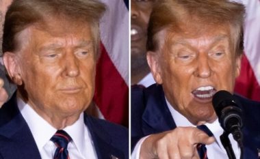 Në internet po përhapen fotot e fundit të Trumpit – çfarë po ndodh me fytyrën e tij