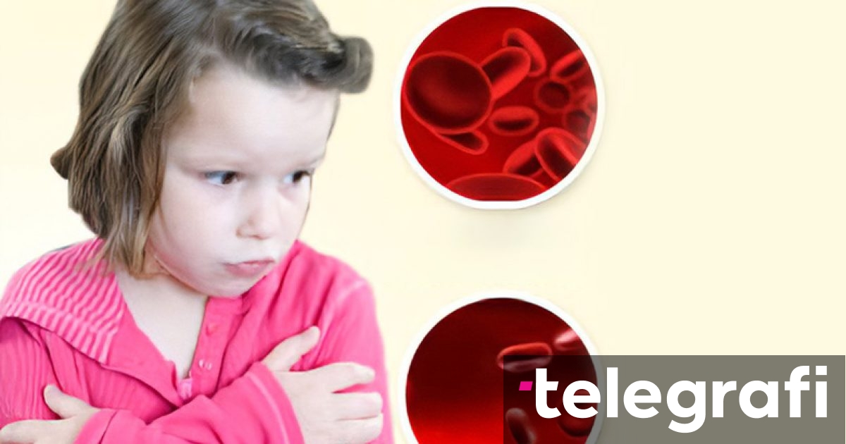 Anemia kurohet nga mjeku, sepse “vetë” trajtimi i gabuar mund të jetë i dëmshëm, veçanërisht te fëmijët