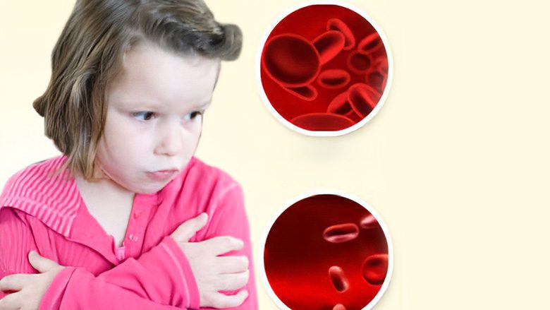 Anemia kurohet nga mjeku, sepse “vetë” trajtimi i gabuar mund të jetë i dëmshëm, veçanërisht te fëmijët