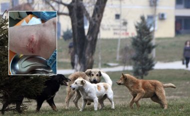 Një qytetar kafshohet nga qentë endacakë afër Shtëpisë së Moshuarve në Prishtinë