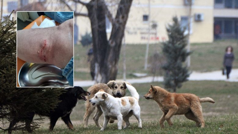 Qentë endacakë kanë kafshuar tre persona në Shkup