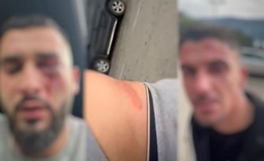 “U sulmuam sepse kishim flamurin shqiptar në veturë” – flet i riu që u rrah barbarisht në Mal të Zi