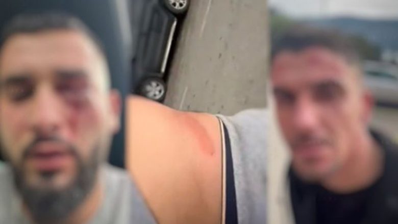 “U sulmuam sepse kishim flamurin shqiptar në veturë” – flet i riu që u rrah barbarisht në Mal të Zi