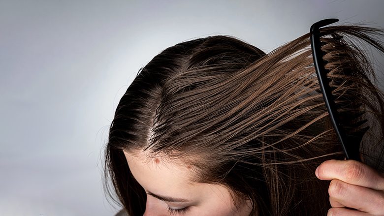 Floktarët zbulojnë mënyrën se si përgjithmonë të zgjidhni problemin me flokët e yndyrshme