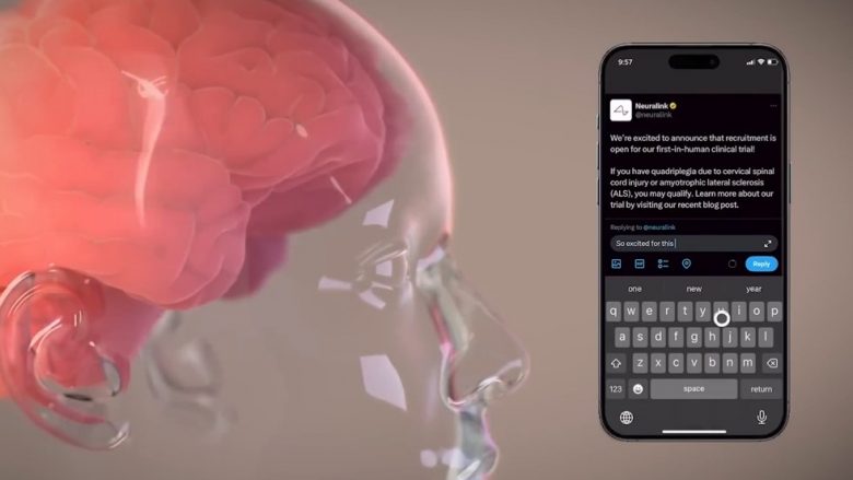 Musk: Njeriu i parë me çip në tru, tani mund të kontrollojë miun e kompjuterit përmes mendjes