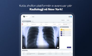 Kutia zhvillon platformën e avancuar për Radiologji në New York 