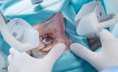 Si duket operacioni i kataraktit: Gjithçka që keni dashur të dini për këtë procedurë