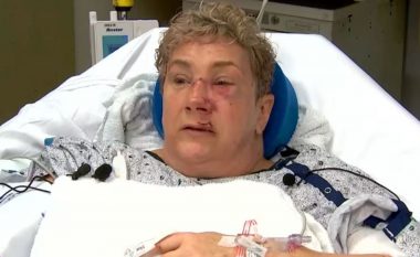 Gruaja nga Pennsylvania rrëfen tmerrin kur u sulmua nga ariu