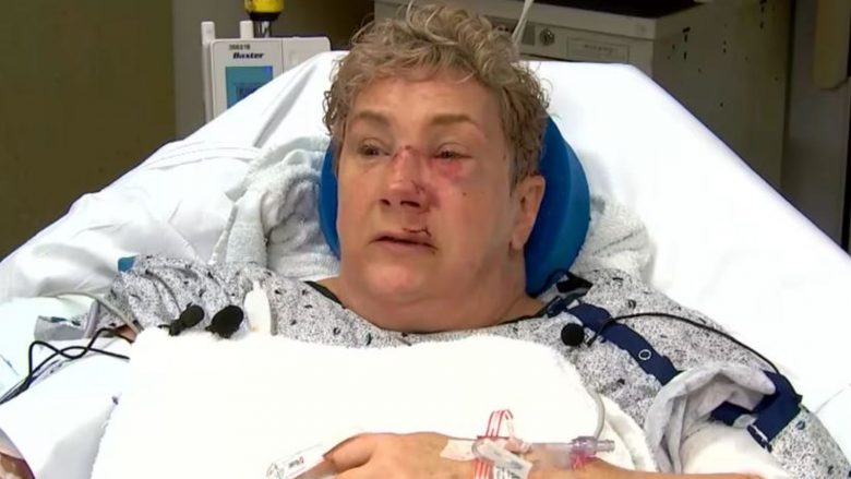 Gruaja nga Pennsylvania rrëfen tmerrin kur u sulmua nga ariu
