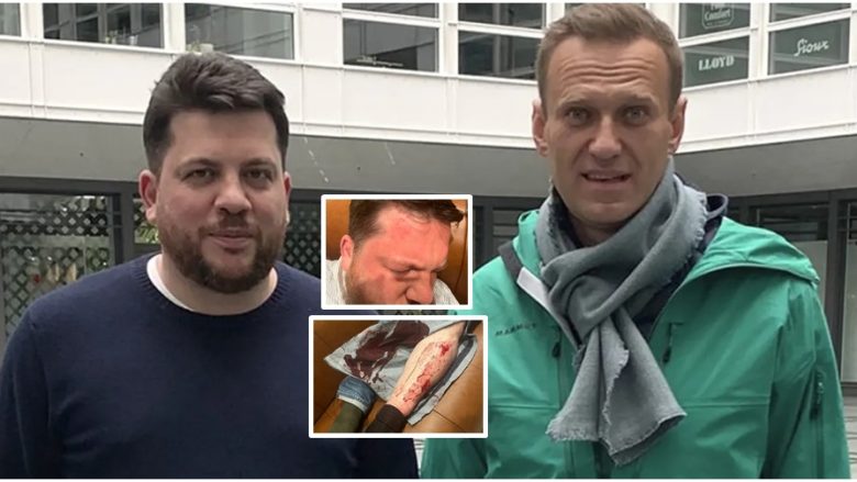 Sulmohet me çekan ndihmësi i Navalnyt