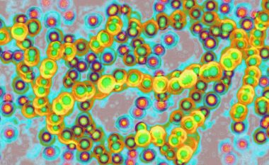 Një infeksion bakterial i rrallë por i rrezikshëm po përhapet me shpejtësi rekord në Japoni – zyrtarët që po përpiqen të identifikojnë shkakun