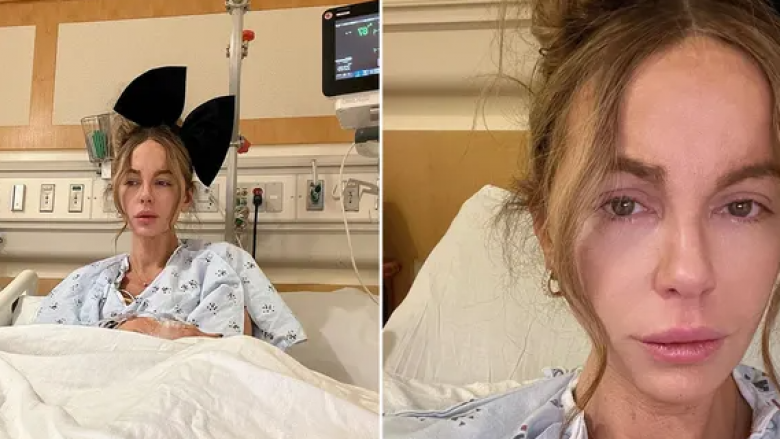 Shfaqet me lot në sy nga spitali, Kate Beckinsale tregon se po përballet me disa probleme shëndetësore